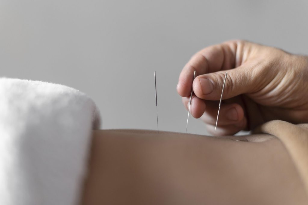 mano-de-primer-plano-sosteniendo-la-aguja-de-acupuntura-scaled